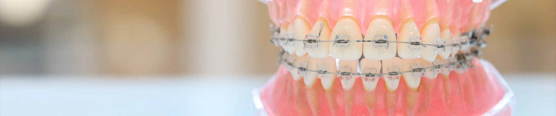 大人の矯正歯科について